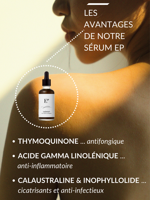 Sérum "ep" apaisant réduit les démangeaisons et régénère la peau. pour les peaux sujettes à l'eczéma et psoriasis.